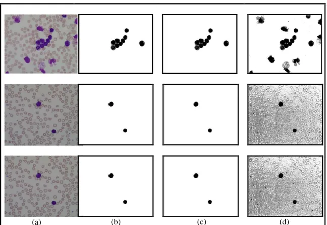 Gambar 12. Hasil Uji Coba Segmentasi Leukosit (a) Citra original (b) citra ground truthnya (c)  TLTH dan (d) TGTH 