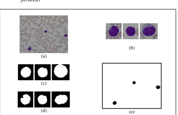 Gambar 8. (a) citra original (b) sub-citra (c) hasil thresholding sitoplasma (d) hasil thresholding  nukleus (e) hasil thresholding sub-citra digabungkan