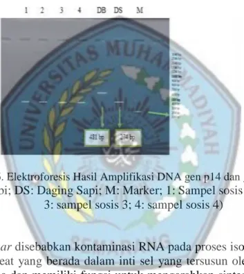 Gambar 6. Elektroforesis Hasil Amplifikasi DNA gen p14 dan gen sapi. 