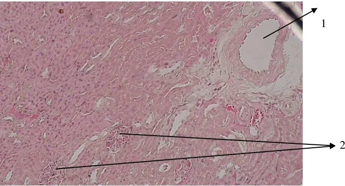 Gambar 5a. Potongan melintang ginjal (400x); arteri (1), dan Glomerulus  (2) 