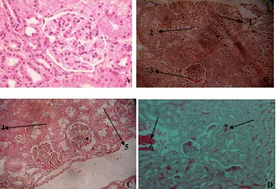 Gambar 5b. Potongan melintang ginjal (400x); kapiler glomerulus (1), kapsula Bowman (2), tubulus kontortus proksimal (3), dan tubulus kontortus distal (4)