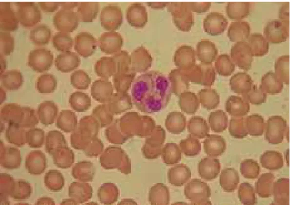 Gambar 2. Bercak darah menunjukkan granulosit neutrofil, di mana tiga lobus nukleus  dapat terlihat