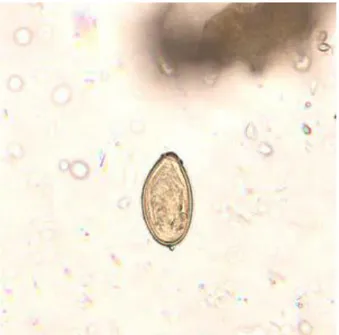 Gambar 9. Telur Opistorchis felineus  (Sumber : CDC, 2012) 