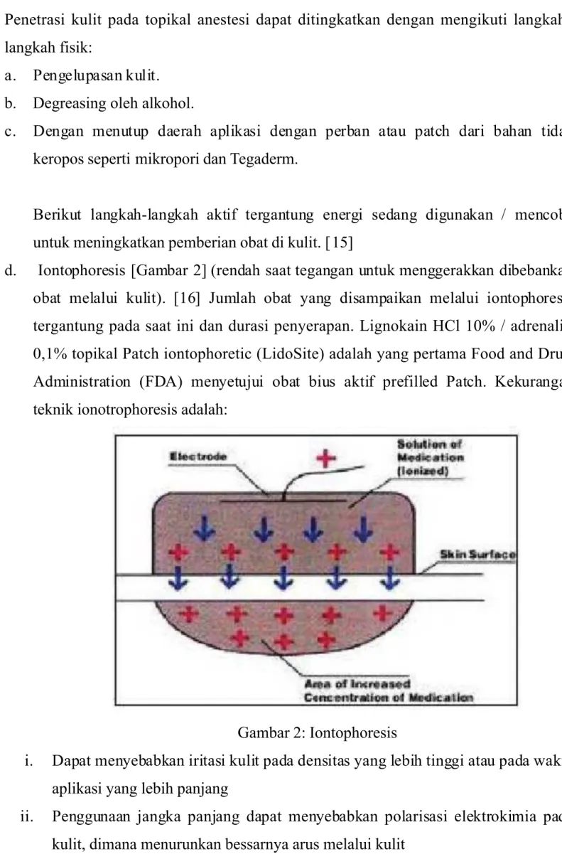 Gambar 90 !ontophoresis