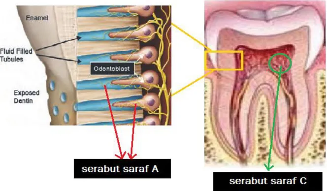 Gambar 1. Reseptor Nyeri: Serabut Saraf A dan Serabut Saraf C 