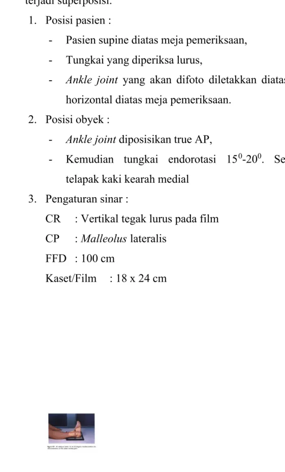 Gambar 7 Ankle joint  Proyeksi Mortise view (Merrill’s, 2012)