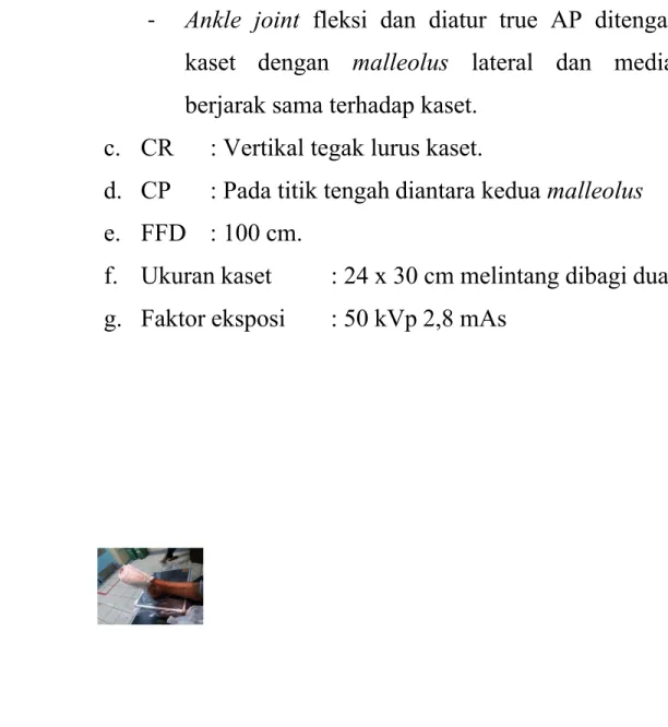 Gambar 11 Pemeriksaan Ankle joint Proyeksi Antero Posterior (AP)