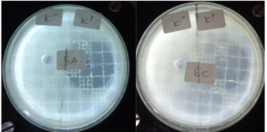 Gambar 2. (a) Ekstrak aseton pada bakteri S. aureus (b) Ekstrak aseton pada bakteri E