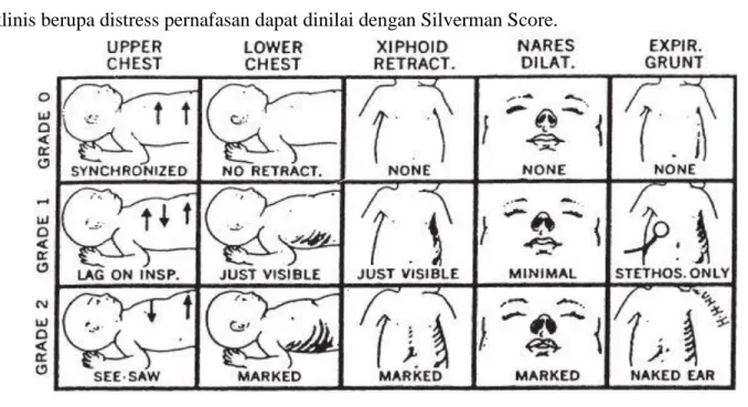 Gambar 2. Silverman score 