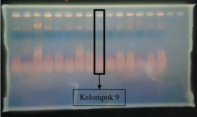 Gambar 4.1 Hasil Foto Elektroforesis DNA Plasmid pET-32b(+) (dokumentasi pribadi,  2015) 