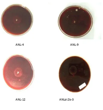 Gambar 3.    Actinomycetes yang mempunyai kemampuan dalam mendegradasi kitin pada media mineral-salt agar plate dengan Kitin 1% dengan pewarnaan Congo Red 1 % 