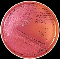 Gambar 6. Koloni Salmonella sp. pada medium Xylose Lysine Deoxycholate Agar  (XLD agar)