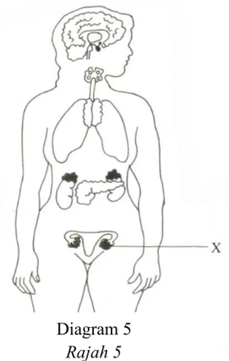 Diagram 5  Rajah 5 