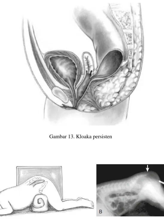 Gambar 14. Cross table X-ray 