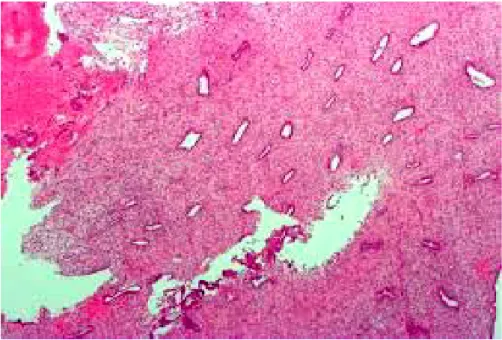 Gambar 2.3 Endometrium secara histologi 24