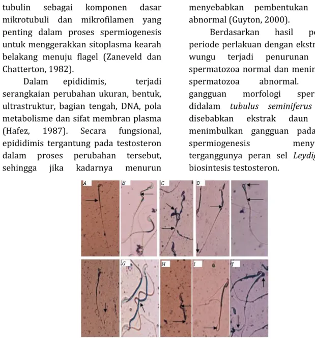 Gambar  1 :   Berbagai kelainan morfologi spermatozoa  Rattus novergicus.L setelah  diberi ekstrak daun wungu