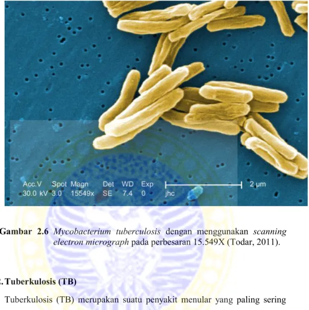 Gambar  2.6  Mycobacterium  tuberculosis  dengan  menggunakan  scanning  electron micrograph pada perbesaran 15.549X (Todar, 2011)