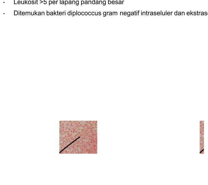 Gambar ). !uman Diplococcus Gram Negatif Intraseluler (an e$straseluler 
