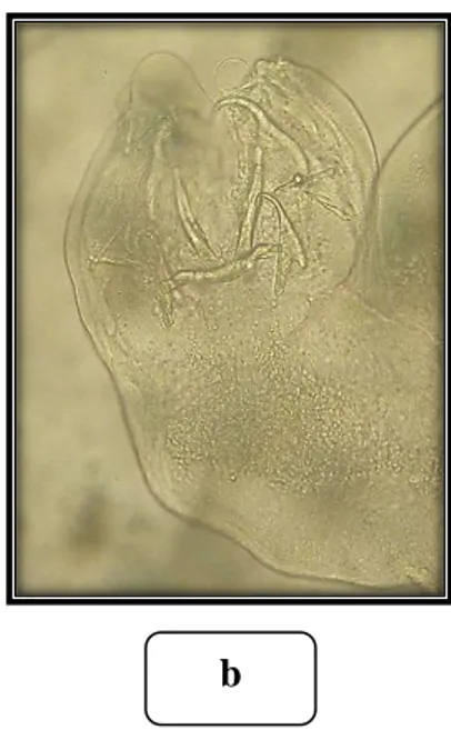 Gambar 8. Cichlidogyrus sp., Pembesaran 10x (a) dan Pembesaran 40x (b)  b.  Prevalensi 