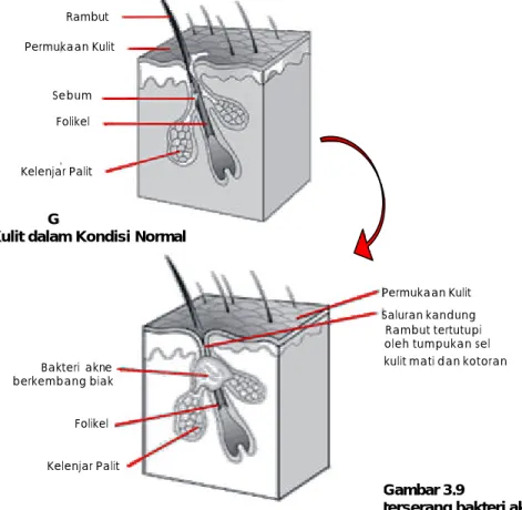 Gambar 3.8  Kulit dalam Kondisi Normal 
