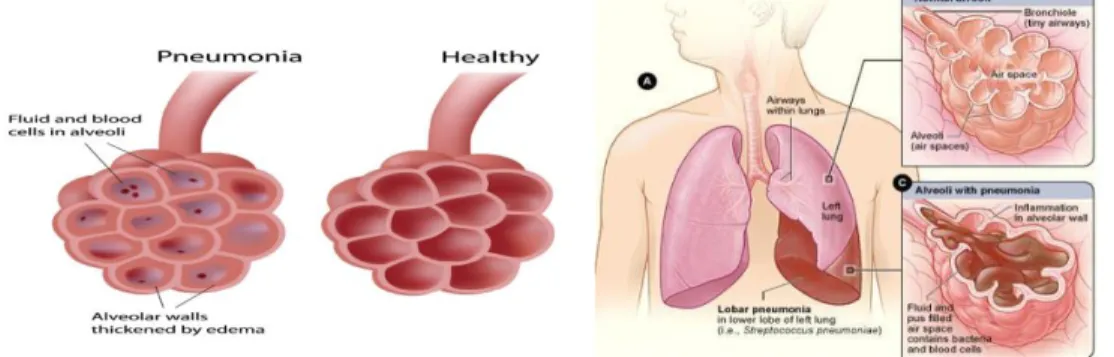 Gambar 2.1. Struktur Sistem Respirasi (Nurarif &amp; Kusuma, 2013) 