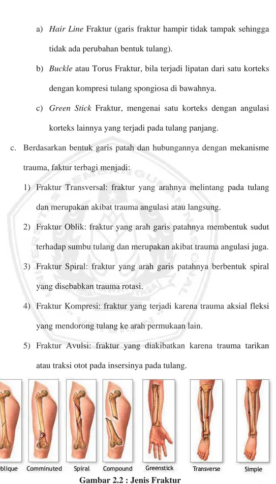 Gambar 2.2 : Jenis Fraktur 