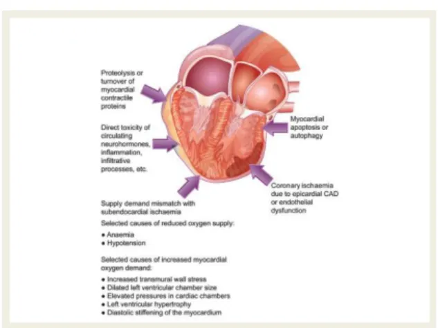 Gambar 5. Meta-Analisis Dari Terapi Gagal  Jantung Dipandu Biomarker 17  2.2  High Sensitivity Troponin 