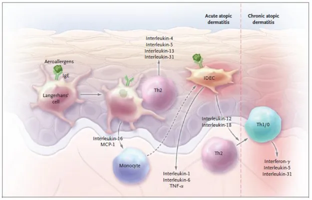 Gambar 3. Fase Akut dan kronik Dermatitis Atopi yang dimediasi oleh IgE dan Sel T. 