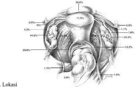 Gambar 1. Lokasi anatomis implantasi endometriosis yang ditemukan melalui laparaskopi