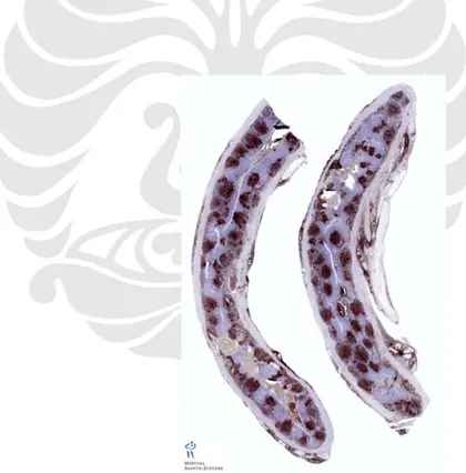 Gambar 2.3. Potongan Memanjang Apendiks Vermivormis Normal secara Mikroskopik  Diunduh dari: http://www.humpath.com/IMG/jpg/cd20_normal_apendiks_12_1.jpg 