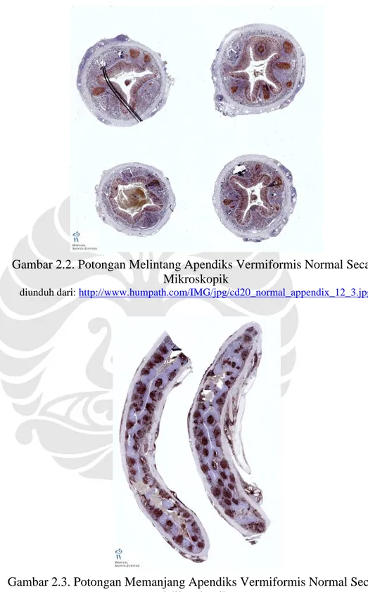 Gambar 2.2. Potongan Melintang Apendiks Vermiformis Normal Secara  Mikroskopik 