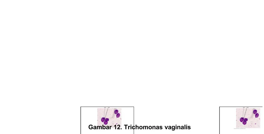 Gambar 12. Trichomonas vaginalis