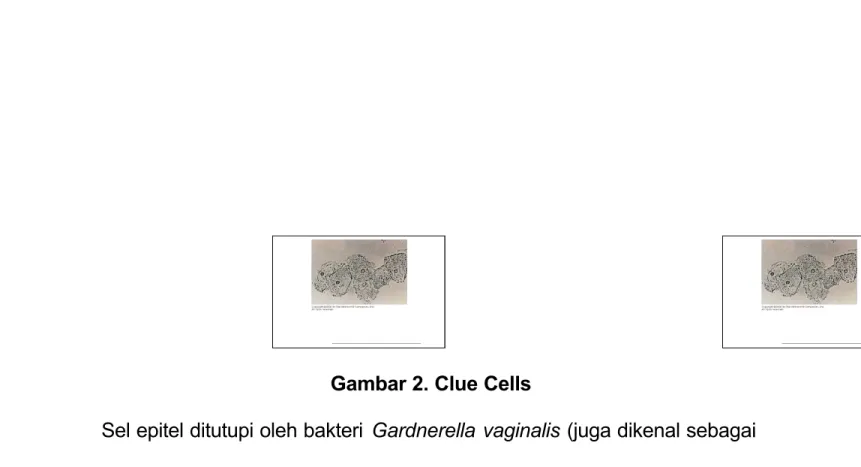Gambar 2. Clue Cells