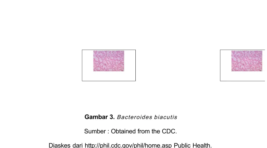 Gambar 3. Bacteroides biacutis  Sumber : Obtained from the CDC.
