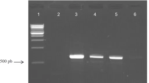 Gambar 1.  Amplikasi gen CP CMV menggunakan one step RT-PCR pada gel agarose 1,5%. 1. Marker 1 Kb, 2