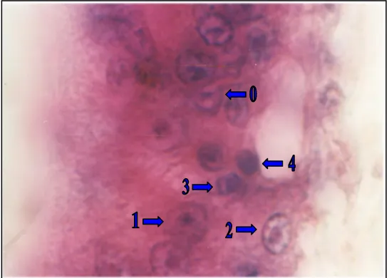 Gambar 1.  Histologi hepatopankreas udang uji yang terinfeksi WSSV (perbesaran 3800x) 