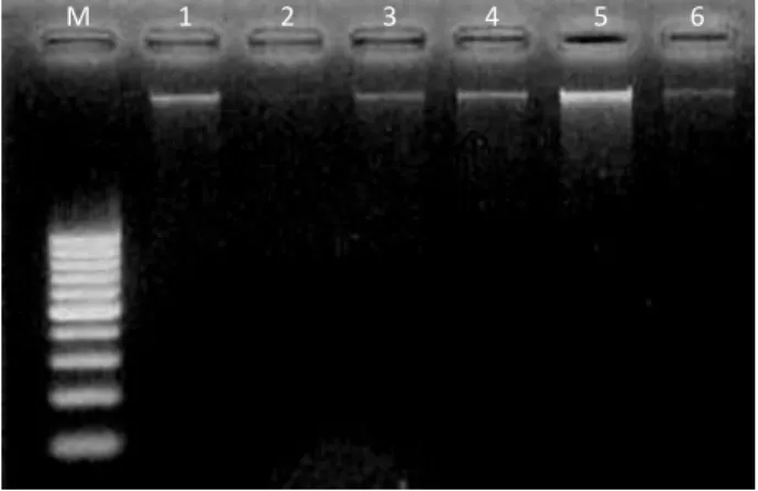 Gambar  1.  Visualisasi  hasil  isolasi  DNA  total  tanaman  lada pada gel agarose 1,5% M