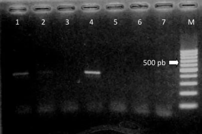 Gambar 2. Visualisasi hasil PCR dengan primer PYMoV-F  dan PYMoV-R pada gel agarose 1,5%