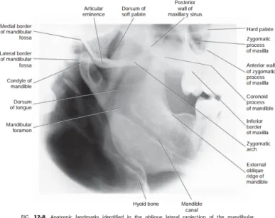 Gambar 14. Hasil radiografik teknik mandibular ramus projection Kriteria Gambaran (Singer, 2008):