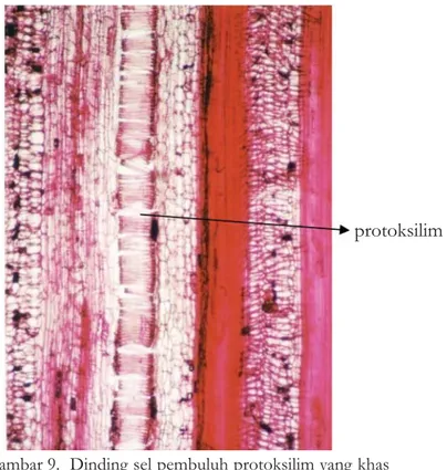 Gambar 9.  Dinding sel pembuluh protoksilim yang khas  berbentuk spiral (Pembesaran 100 X ) 