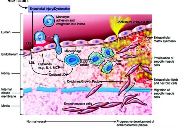 Gambar 2.2  Patogenesis Inflamasi pada Aterosklerosis (Packard 2008). 