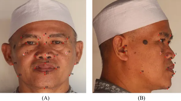Gambar 1 Letak titik anatomi wajah pria depan (A) dan samping (B)  Tabel 1 Letak dan deskripsi titik anatomis wajah depan (Juliandi 2000) 