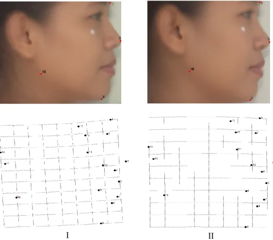 Gambar 9 Tipe I dan II wajah samping wanita dengan grid deformasinya  Wajah  samping  wanita  (Gambar  9)  tipe  I  memiliki  memiliki  dahi  lebar,  dagu pendek, rahang besar dan hidung mancung