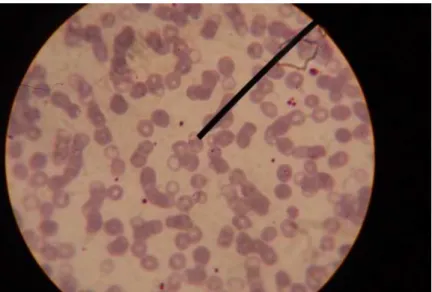 Gambar 2.3: Sampel 1 Sediaan Darah Tipis Plasmodium  Falciparum 