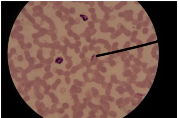 Gambar 2.4: Sampel 2 Sediaan Darah Tipis Plasmodium  Falciparum 