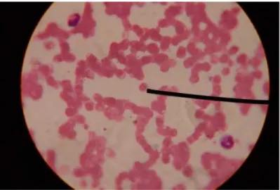 Gambar 2.8: Sampel 1 Sediaan Darah Tipis Plasmodium  Malariae 