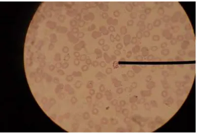Gambar 2.9: Sampel 2 Sediaan Darah Tipis Plasmodium  Malariae 
