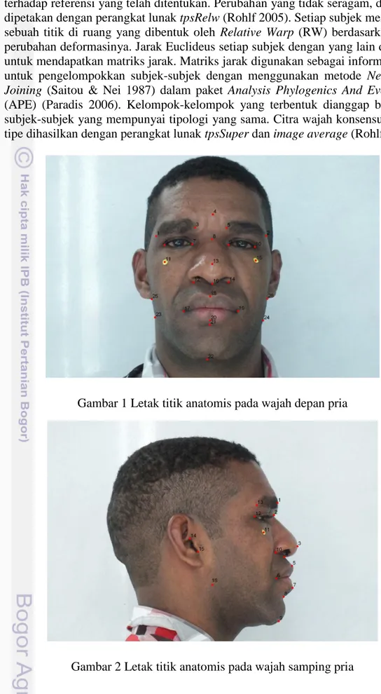 Gambar 2 Letak titik anatomis pada wajah samping pria 