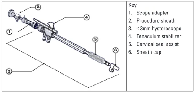 figure 4-7: Procedure Sheath Assembly Key