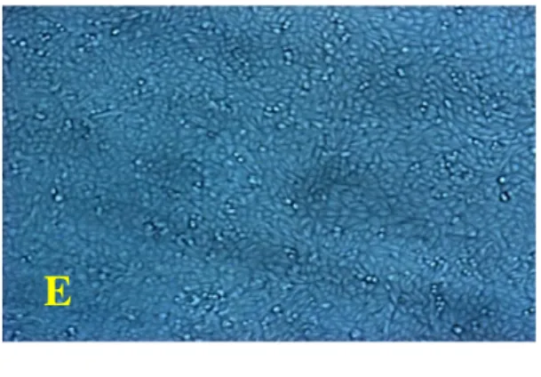 Foto mikroskopis sel kanker payudara T47D yang diberi perlakuan  dengan ekstrak etanol  kulit  buah asam kandis dengan konsentrasi A= 100 µg/ml ; B= 10 µg/ml ; C= 1 µg/ml ; D= 